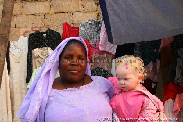 Mãe Lúcia e a filha albina